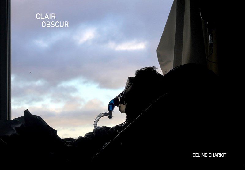 Clair obscur - Immersion à l'hôpital de la Citadelle à Liège